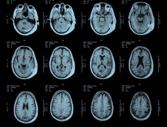 Mind 05 MRI brain scan